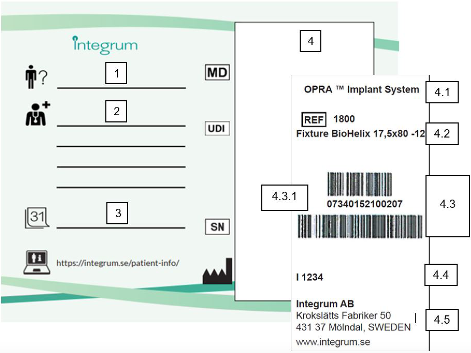 Implant Card infographic