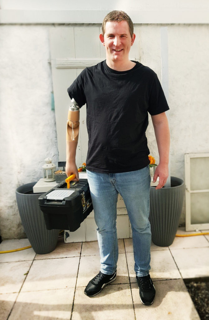 Man with bone-anchored above elbow prosthesis carrying toolbox